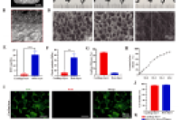 基于分层脱钙骨框架和预软骨化微球的双相仿生支架，实现骨软骨缺损修复
