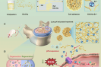 靶向退变微环境！锶递送系统重塑氧化还原稳态，力阻椎间盘退行性变