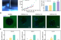 靶向锚定 + 抗炎再生双管齐下，新型水凝胶微球让骨关节炎治疗更精准