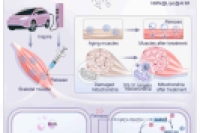 缓解肌少症有新招！重医附一院团队开发靶向线粒体的能量补充水凝胶微球
