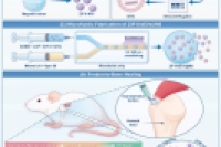 生物无机杂化微球系统！调控免疫-软骨生成微环境，实现腱骨愈合