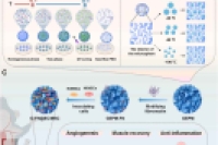 仿生可注射层级多孔微球，用于重症肢体缺血的协同细胞治疗