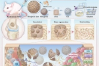 可注射多孔微球负载仿生预处理BMSC来源外泌体，用于血管化骨再生